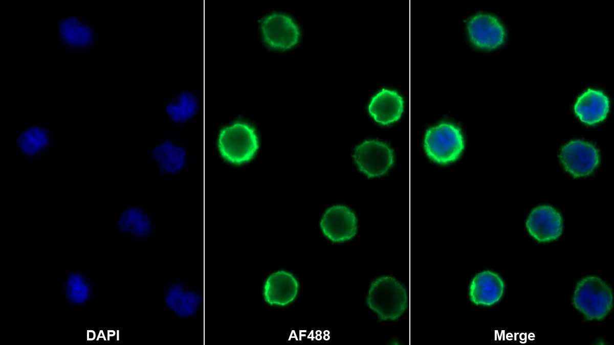 Polyclonal Antibody to Major Histocompatibility Complex Class I E (MHCE)