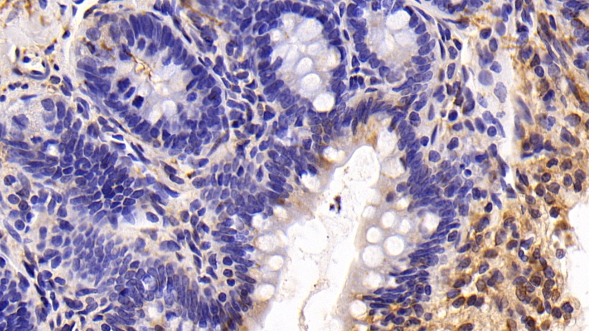 Polyclonal Antibody to Glutamate Receptor Interacting Protein 1 (GRIP1)