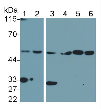 Polyclonal Antibody to Interferon Regulatory Factor 4 (IRF4)