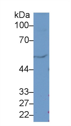 Polyclonal Antibody to Fascin (FSCN)