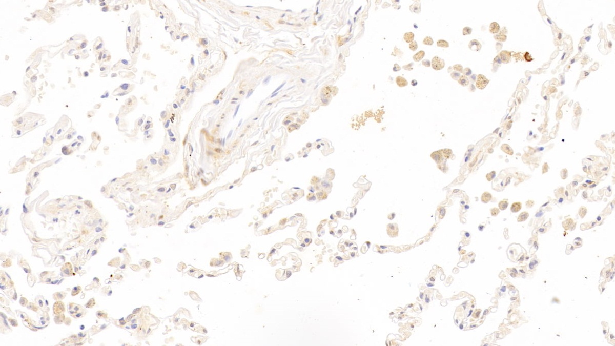 Polyclonal Antibody to Fascin (FSCN)