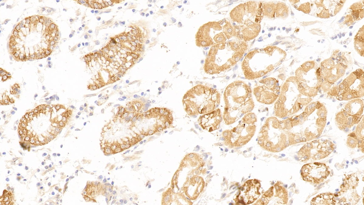 Polyclonal Antibody to Fascin (FSCN)