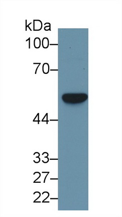 Polyclonal Antibody to Fascin (FSCN)