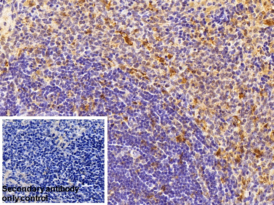 Polyclonal Antibody to Fascin (FSCN)