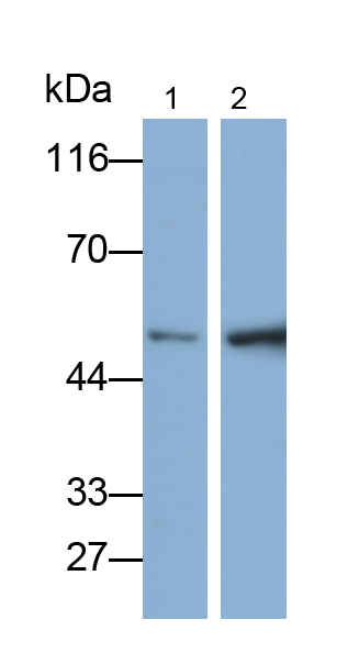 Polyclonal Antibody to Hydroxymethylglutaryl Coenzyme A Synthase (HMGCS)