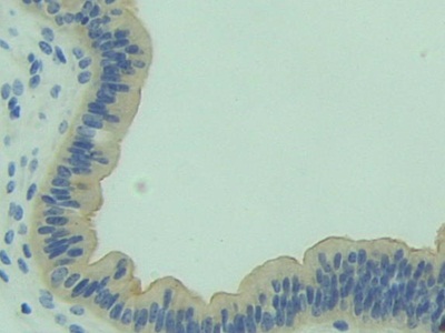 Polyclonal Antibody to Hydroxymethylglutaryl Coenzyme A Synthase (HMGCS)