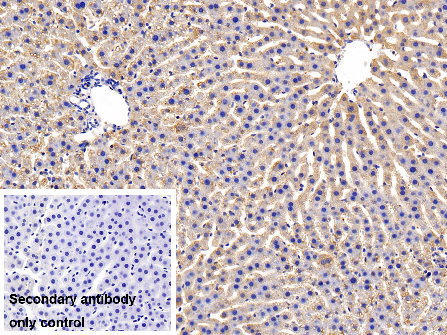 Polyclonal Antibody to Oncostatin M Receptor (OSMR)