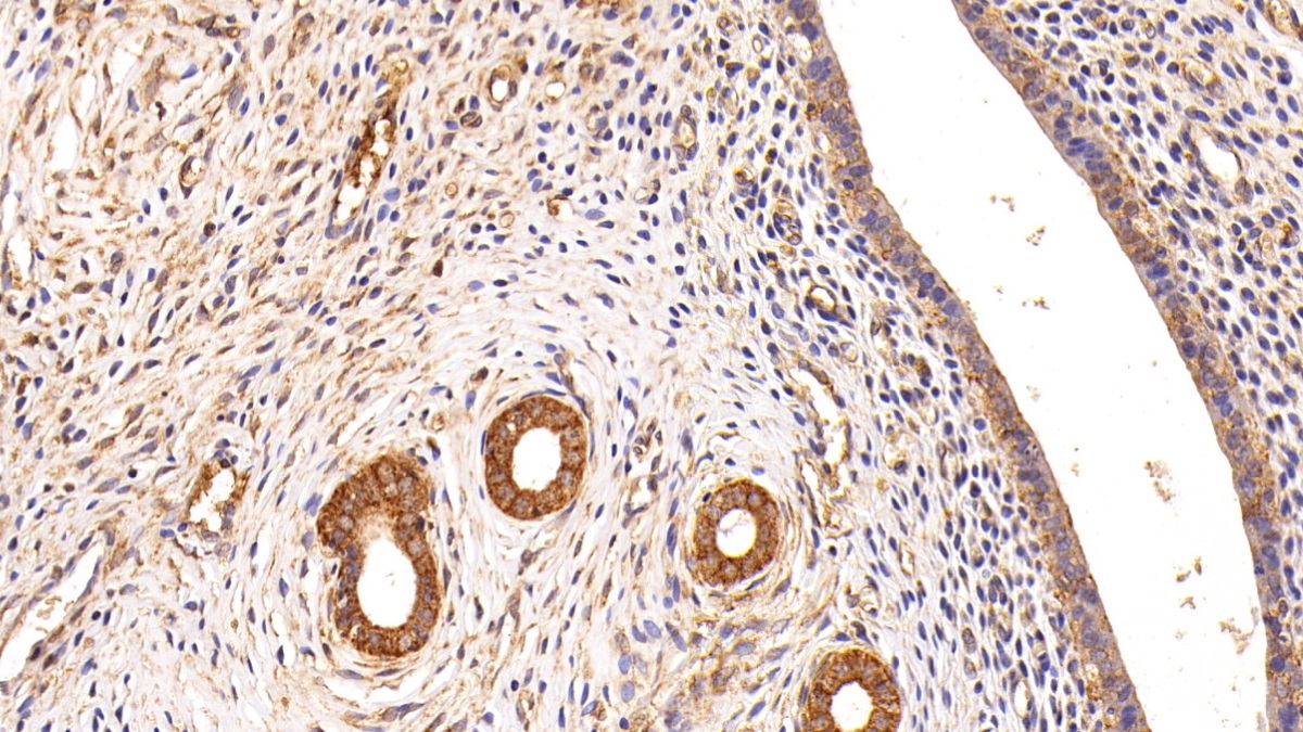 Polyclonal Antibody to Inhibin Beta B (INHbB)