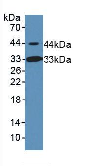 Polyclonal Antibody to Inhibin Beta B (INHbB)