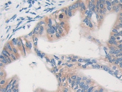 Polyclonal Antibody to Major Vault Protein (MVP)