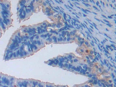 Polyclonal Antibody to Lectin Galactoside Binding, Soluble 3 Binding Protein (LGALS3BP)