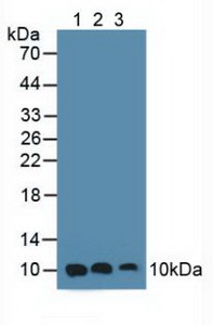 Polyclonal Antibody to S100 Calcium Binding Protein A6 (S100A6)