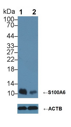 Polyclonal Antibody to S100 Calcium Binding Protein A6 (S100A6)