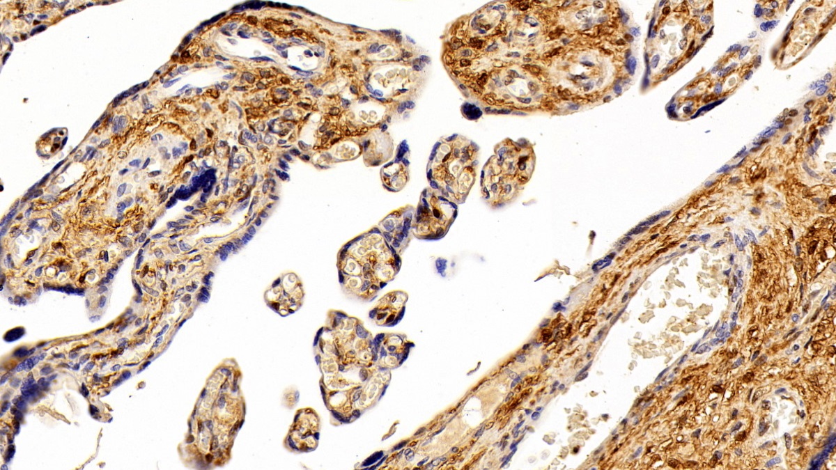 Polyclonal Antibody to S100 Calcium Binding Protein A6 (S100A6)