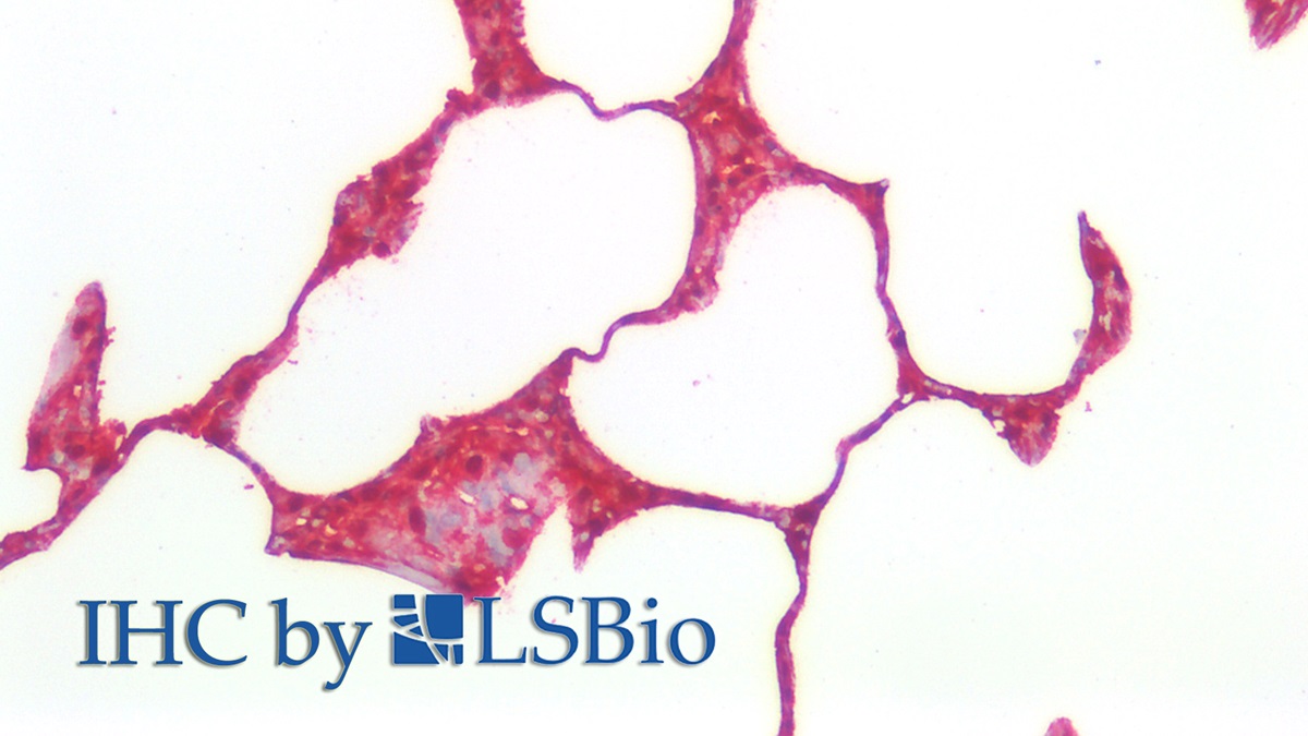 Polyclonal Antibody to S100 Calcium Binding Protein A6 (S100A6)