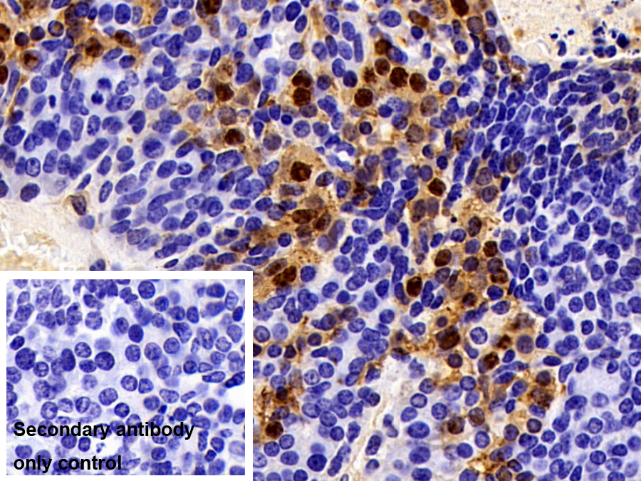 Polyclonal Antibody to S100 Calcium Binding Protein A6 (S100A6)