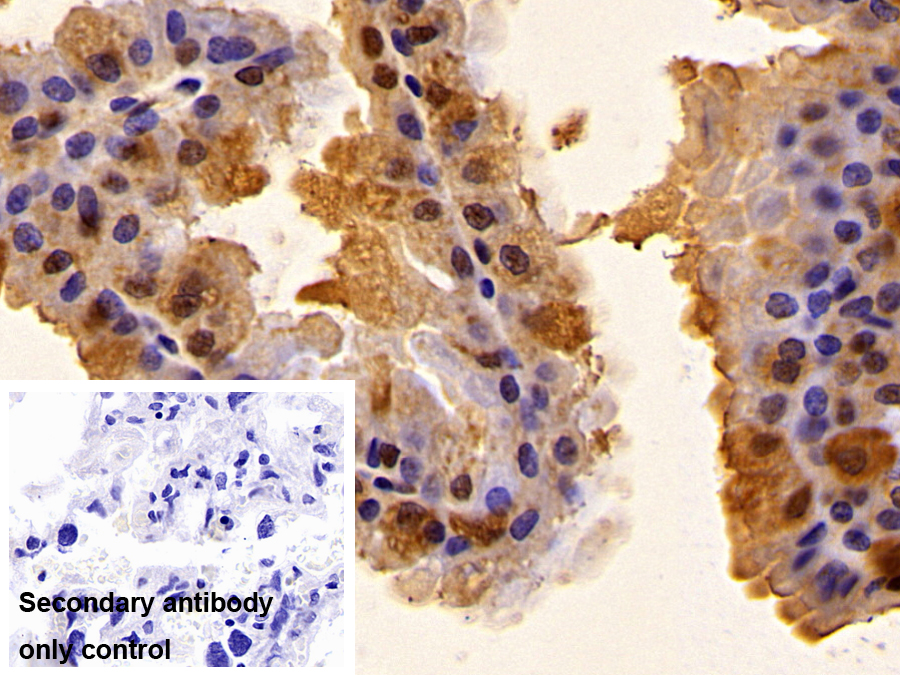 Polyclonal Antibody to S100 Calcium Binding Protein A6 (S100A6)