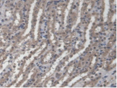 Polyclonal Antibody to Guanylate Binding Protein 4 (GBP4)