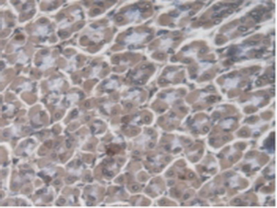 Polyclonal Antibody to Guanylate Binding Protein 4 (GBP4)