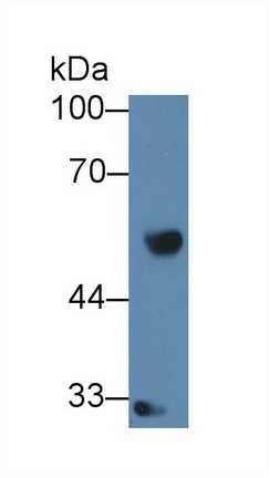 Polyclonal Antibody to Interferon Regulatory Factor 8 (IRF8)