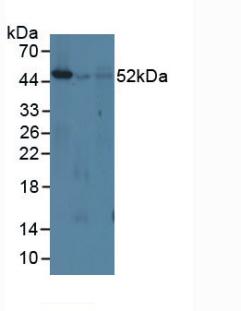 Polyclonal Antibody to Interferon Regulatory Factor 8 (IRF8)