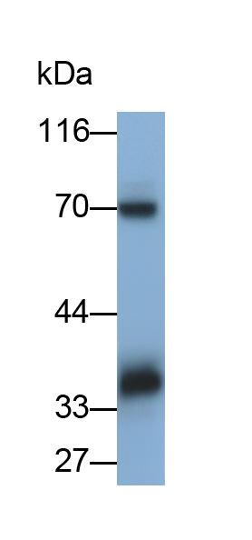 Polyclonal Antibody to Bone Marrow Stromal Cell Antigen 2 (BST2)