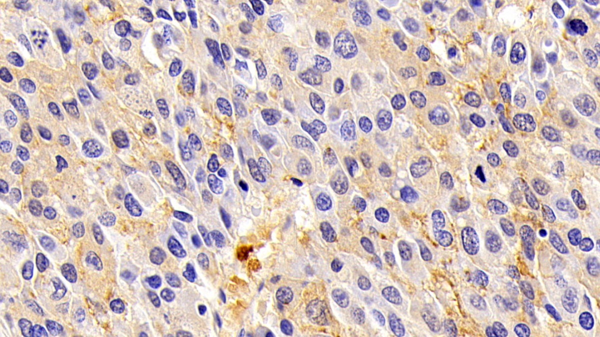 Polyclonal Antibody to Orosomucoid 2 (ORM2)