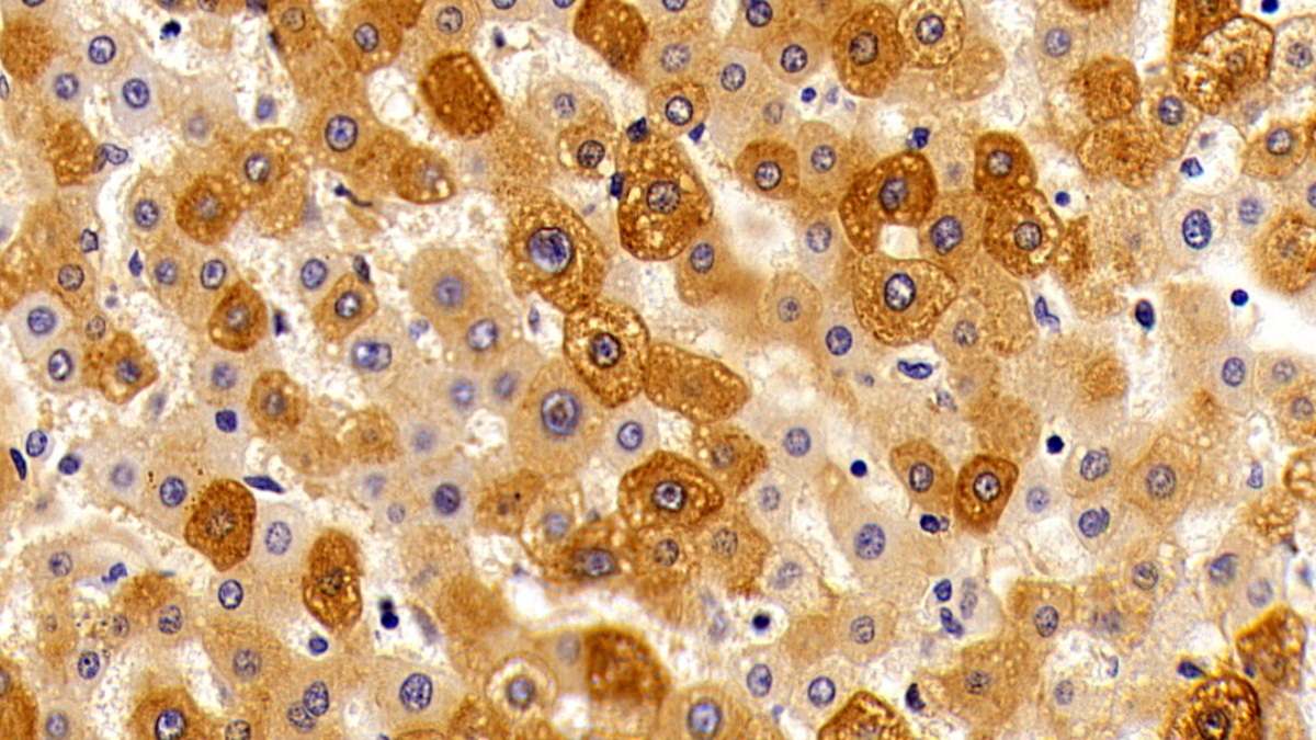 Polyclonal Antibody to Orosomucoid 2 (ORM2)