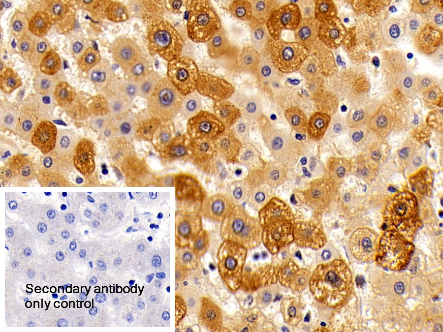 Polyclonal Antibody to Orosomucoid 2 (ORM2)