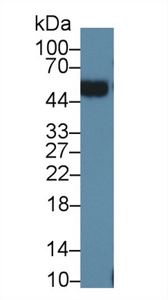 Polyclonal Antibody to Orosomucoid 2 (ORM2)