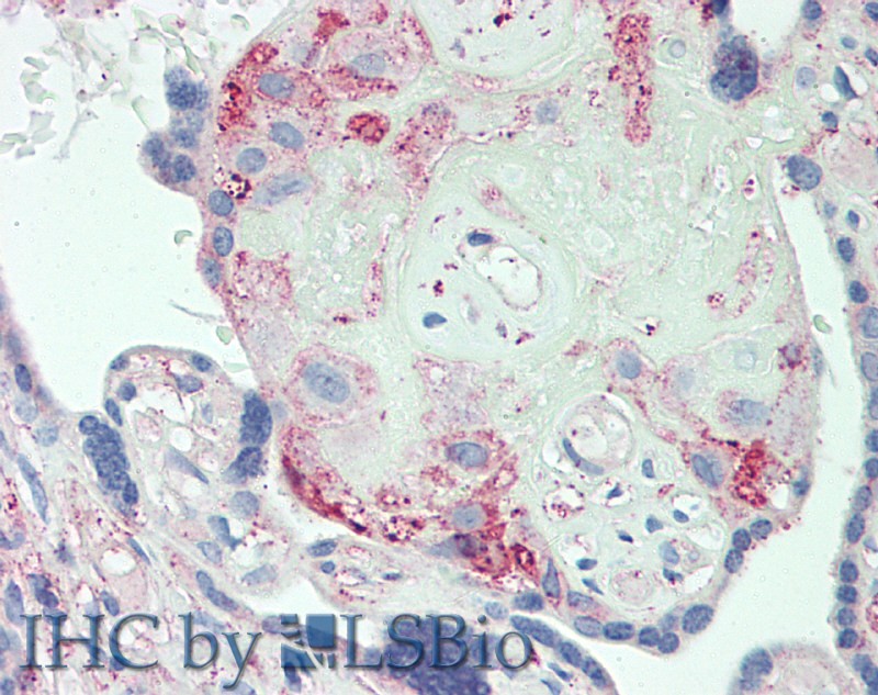 Polyclonal Antibody to Orosomucoid 2 (ORM2)