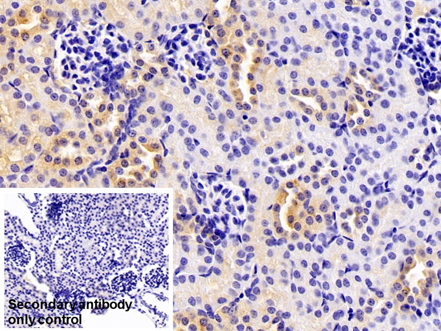 Polyclonal Antibody to Orosomucoid 2 (ORM2)