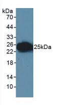 Polyclonal Antibody to Junctional Adhesion Molecule 1 (JAM1)