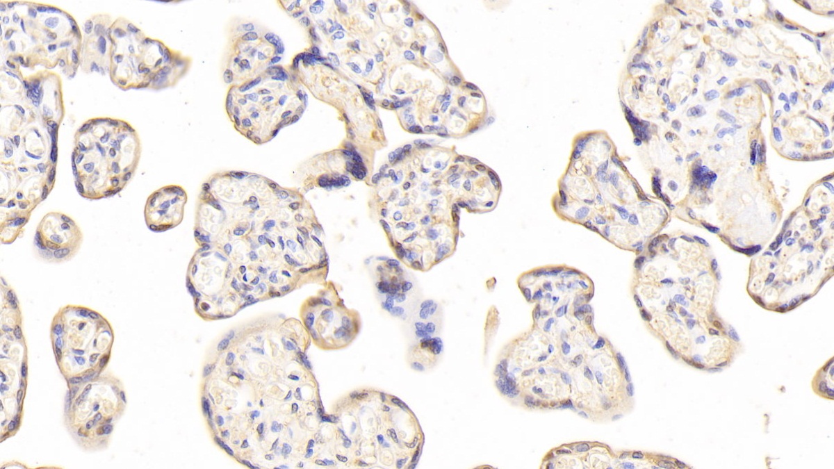 Polyclonal Antibody to Junctional Adhesion Molecule 2 (JAM2)