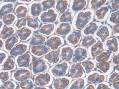 Polyclonal Antibody to Cluster Of Differentiation 7 (CD7)