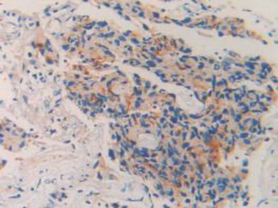 Polyclonal Antibody to Neprilysin (CD10)