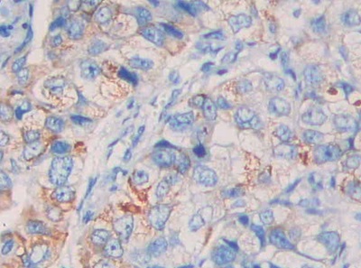 Polyclonal Antibody to Neprilysin (CD10)