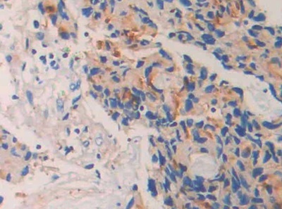 Polyclonal Antibody to Neprilysin (CD10)