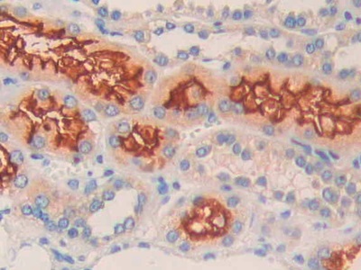 Polyclonal Antibody to Neprilysin (CD10)