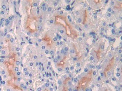 Polyclonal Antibody to Neprilysin (CD10)