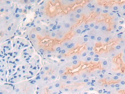 Polyclonal Antibody to Neprilysin (CD10)