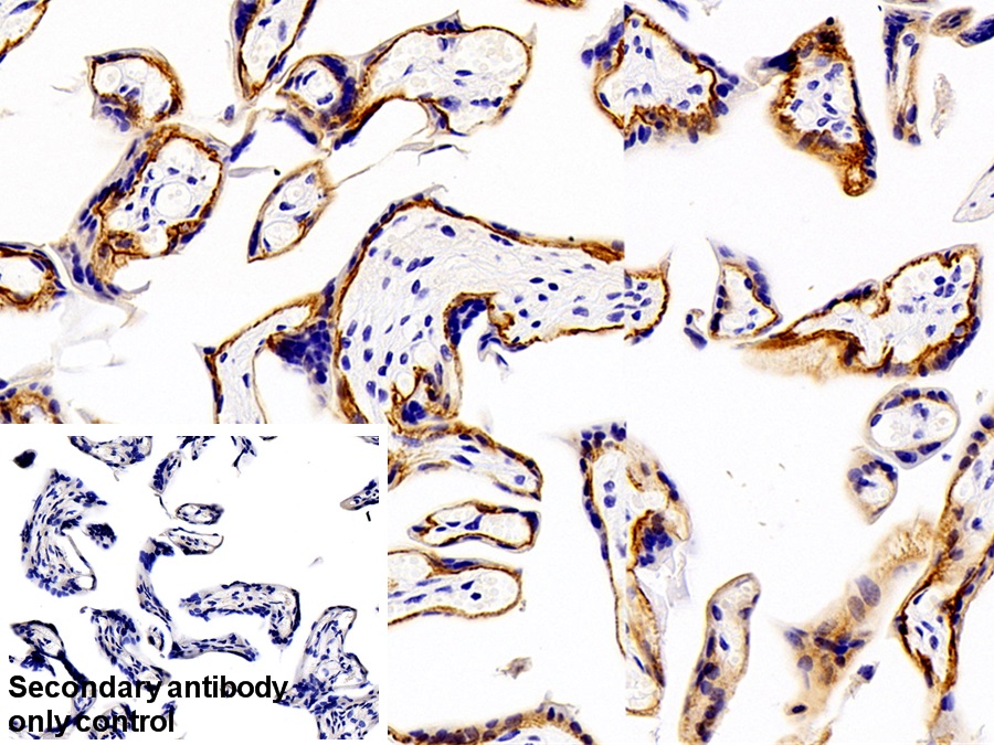 Polyclonal Antibody to Tumor Associated Calcium Signal Transducer 2 (TACSTD2)