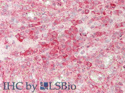 Polyclonal Antibody to Sialic Acid Binding Ig Like Lectin 7 (SIGLEC7)