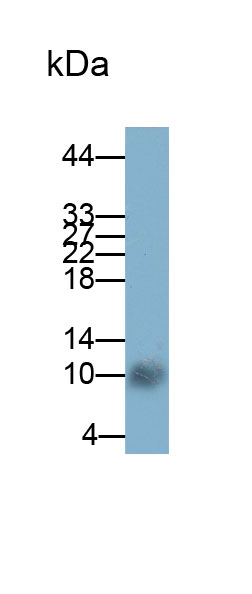 Polyclonal Antibody to S100 Calcium Binding Protein A8 (S100A8)