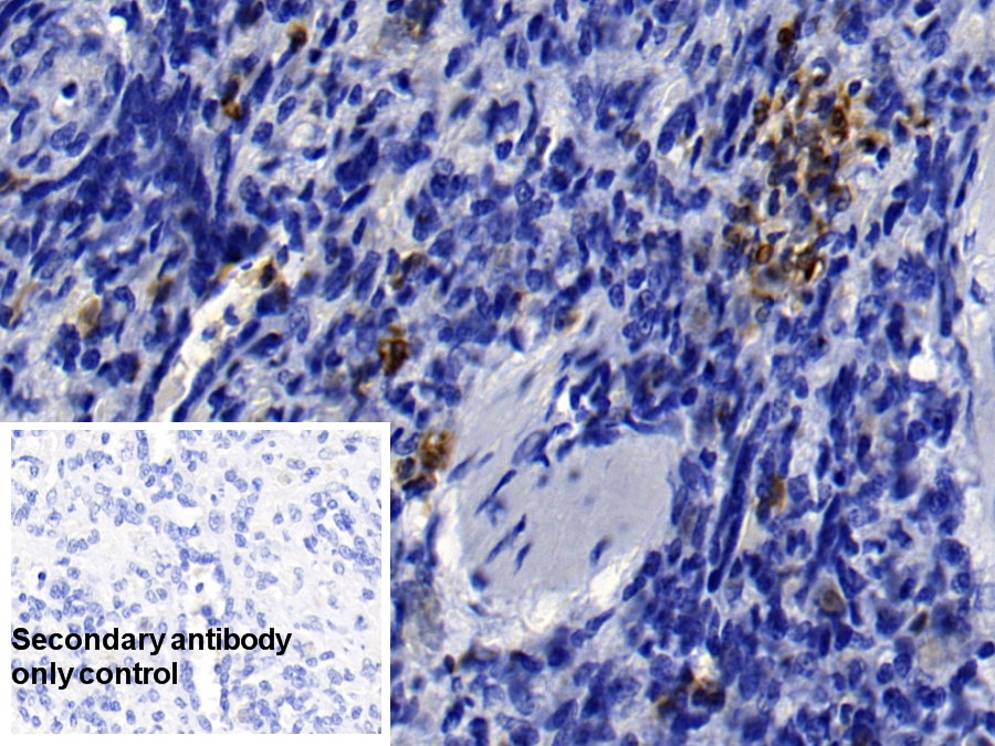 Polyclonal Antibody to S100 Calcium Binding Protein A8 (S100A8)