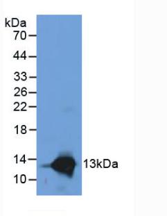 Polyclonal Antibody to S100 Calcium Binding Protein A8 (S100A8)