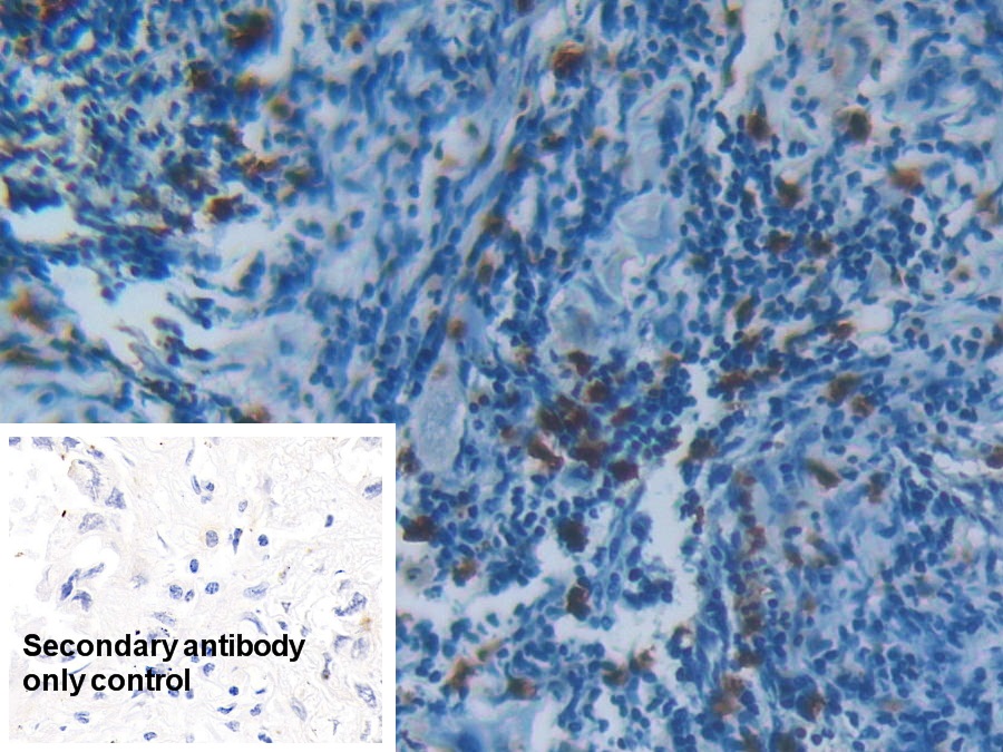 Polyclonal Antibody to S100 Calcium Binding Protein A8 (S100A8)