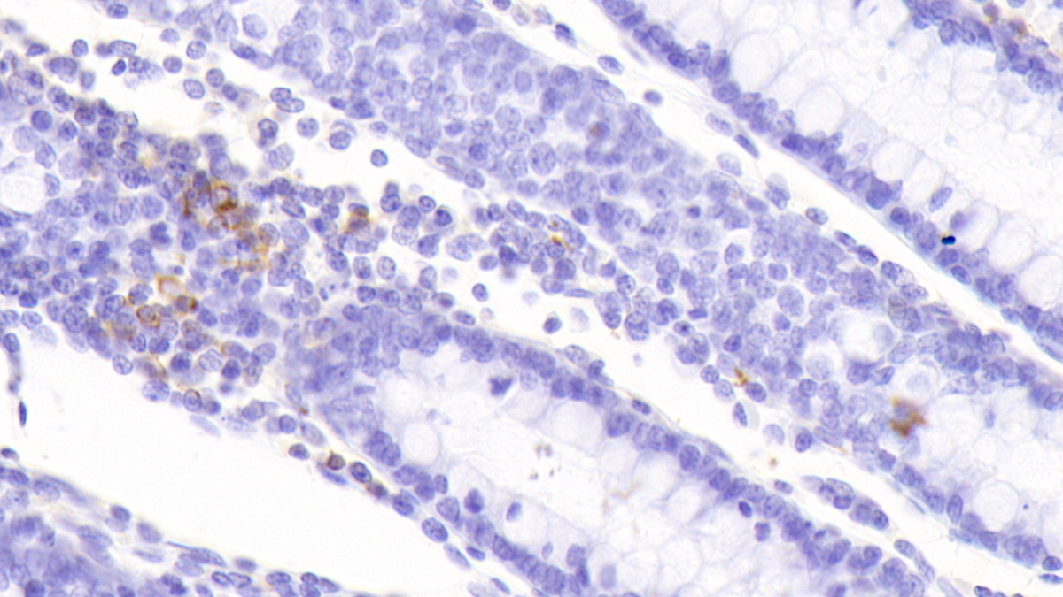 Polyclonal Antibody to S100 Calcium Binding Protein A8 (S100A8)