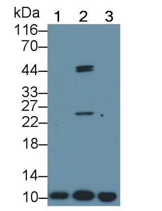 Polyclonal Antibody to S100 Calcium Binding Protein A8 (S100A8)