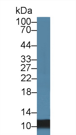 Polyclonal Antibody to S100 Calcium Binding Protein A8 (S100A8)